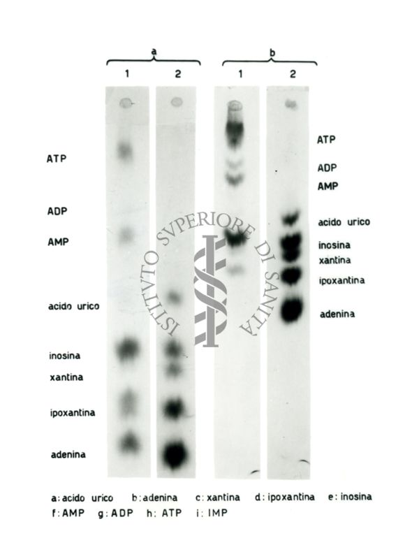 Studio relativo a sostanze trattate con solventi (in esito ad analisi cromatografiche) - a: acido urico; b: adenina; c: xantina; d: ipoxantina; e: inosina; f: AMP; g: ADP; h: ATP; i: IMP