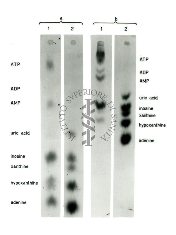 Studio relativo a sostanze trattate con solventi (in esito ad analisi cromatografiche) - a: acido urico; b: adenina; c: xantina; d: ipoxantina; e: inosina; f: AMP; g: ADP; h: ATP; i: IMP