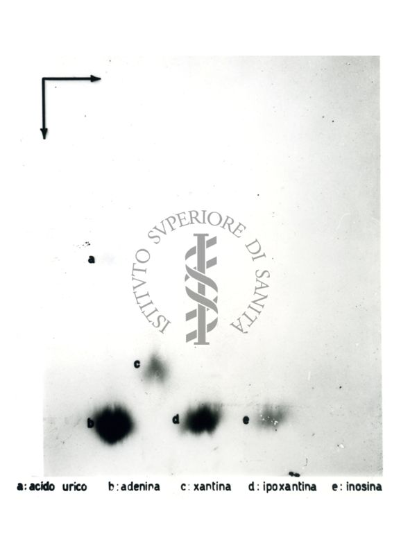 Studio relativo a sostanze trattate con solventi (in esito ad analisi cromatografiche) - a: acido urico; b: adenina; c: xantina; d: ipoxantina; e: inosina