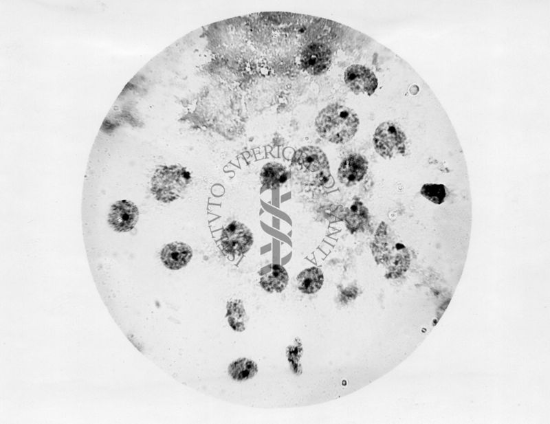 Nuclei di corpo luteo colorati al carminio acetico secondo Barzilai - microfotografia originale 450 ingr.