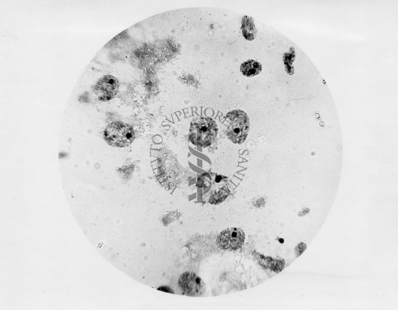 Nuclei di corpo luteo colorati al carminio acetico secondo Barzilai - microfotografia originale 450 ingr.