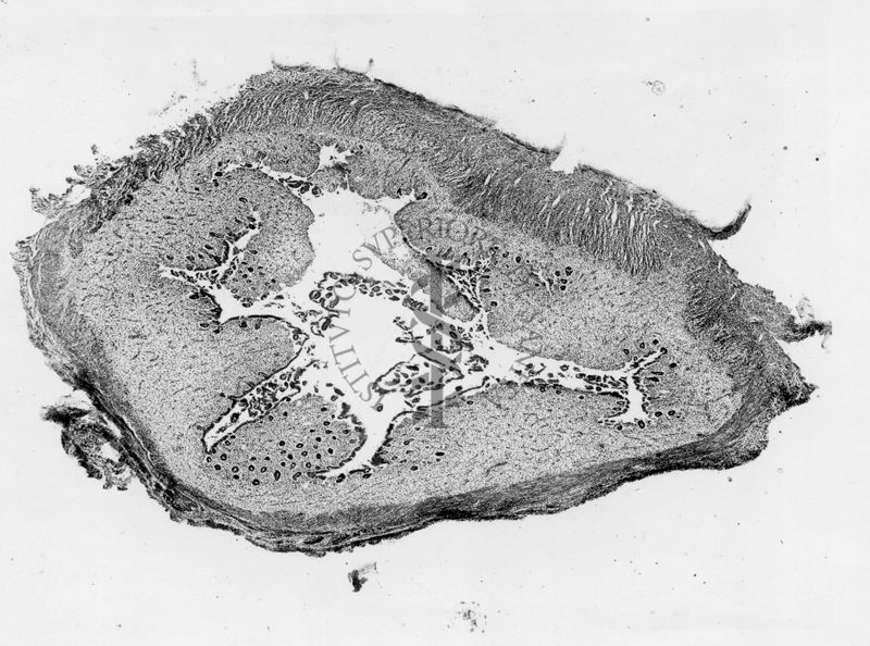 Intestino -  microfotografia fotografia originale 20 ingr.