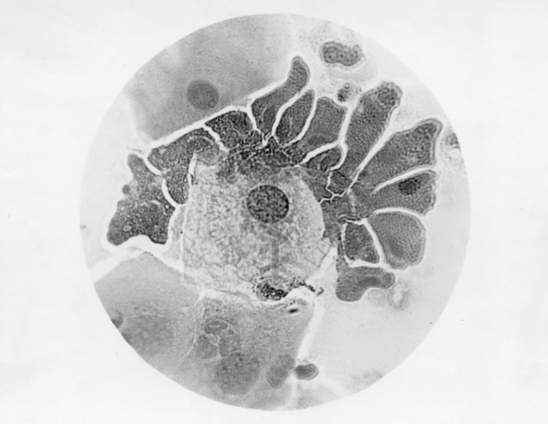 Preparato istologico con tricomonas -  microfotografia fotografia originale 1800 ingr.