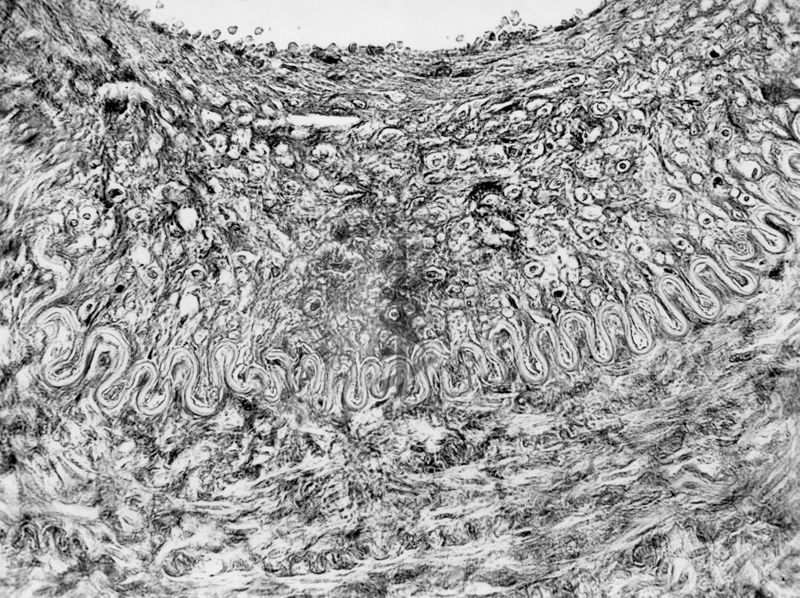 Comportamento delle pareti arteriose di fronte a sostanze irritanti per la cura degli aneurismi - microfotografia fotografia originale 400 ingr.