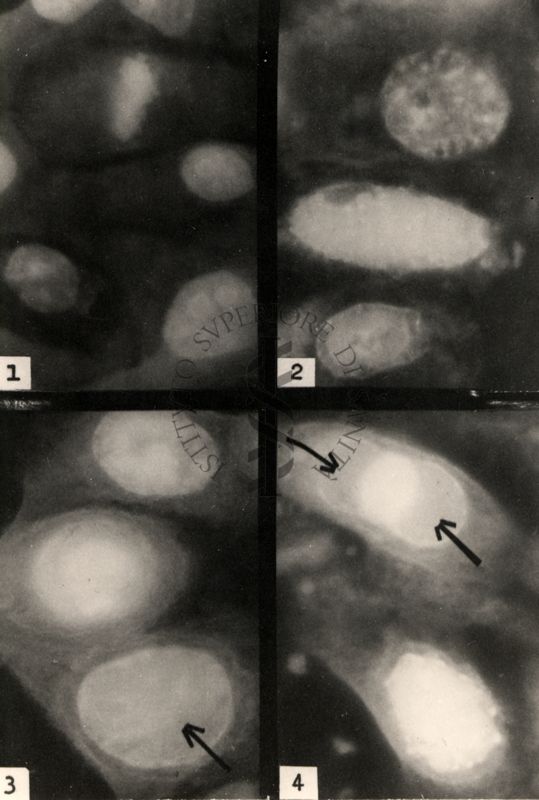 Montaggio di fotografie al microscopio