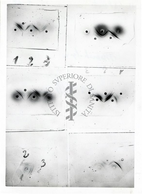 Studi microbiologici su strisce elettroforetiche di membrane di cellulosa