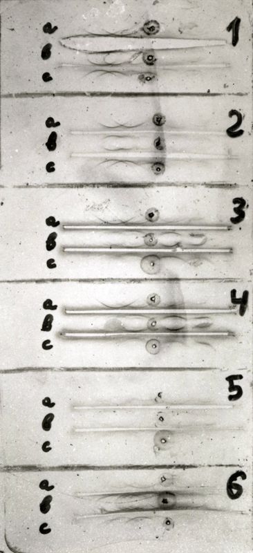 Studi microbiologici su strisce elettroforetiche di membrana di cellulosa