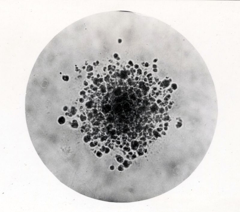 Studi microbiologici non identificati