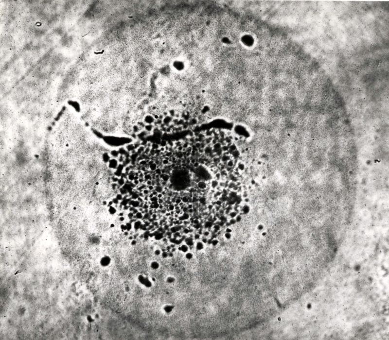 Studi microbiologici non identificati