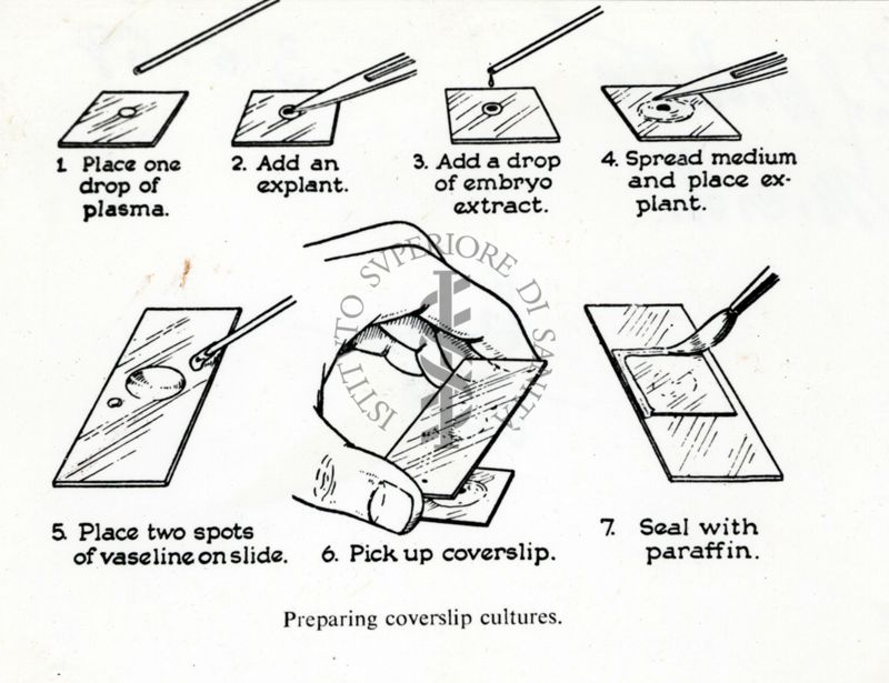 Schema di preparazione di un vetrino per microscopio