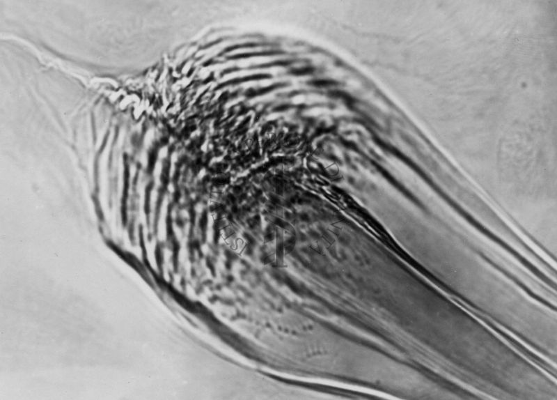 Microfotografia illustrante differenze morfologiche tra le specie P. Perniciosus e P. Perfiliewi