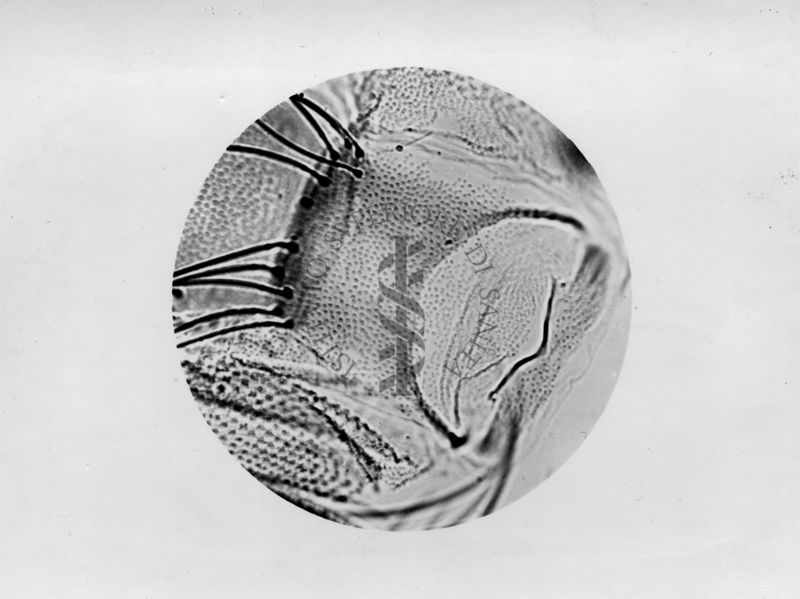 Microfotografia illustrante differenze morfologiche tra le specie P. Perniciosus e P. Perfiliewi