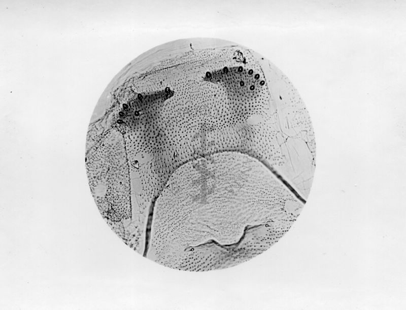 Microfotografia illustrante differenze morfologiche tra le specie P. Perniciosus e P. Perfiliewi