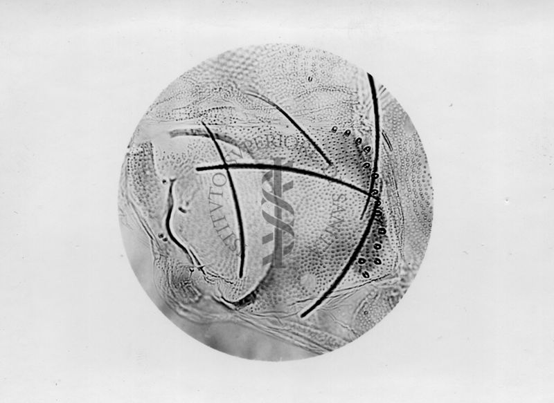 Microfotografia illustrante differenze morfologiche tra le specie P. Perniciosus e P. Perfiliewi