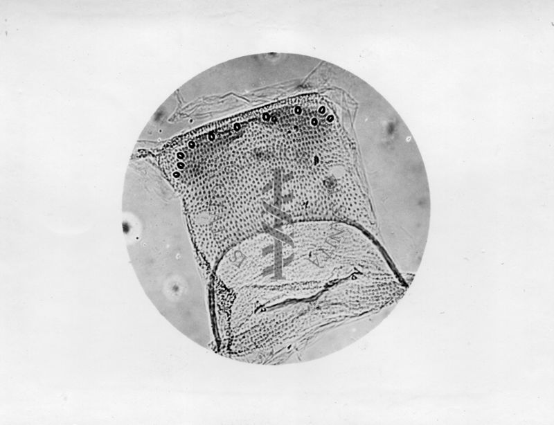 Microfotografia illustrante differenze morfologiche tra le specie P. Perniciosus e P. Perfiliewi