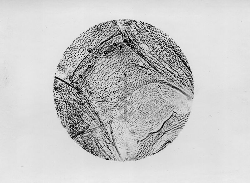 Microfotografia illustrante differenze morfologiche tra le specie P. Perniciosus e P. Perfiliewi