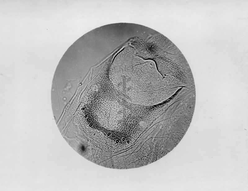 Microfotografia illustrante differenze morfologiche tra le specie P. Perniciosus e P. Perfiliewi