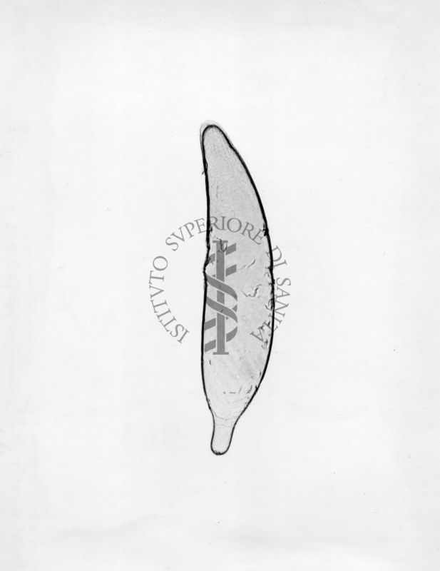 Ova di Pseudotorimus Kisienwetteri. Orymus sinensis Kamijo, 1982, è un insetto parassitoide appartenente all'ordine degli Imenotteri