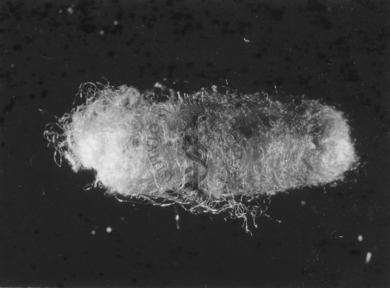 Bozzolo di Lellis estratto dal sacco ovigero di Latrodectus