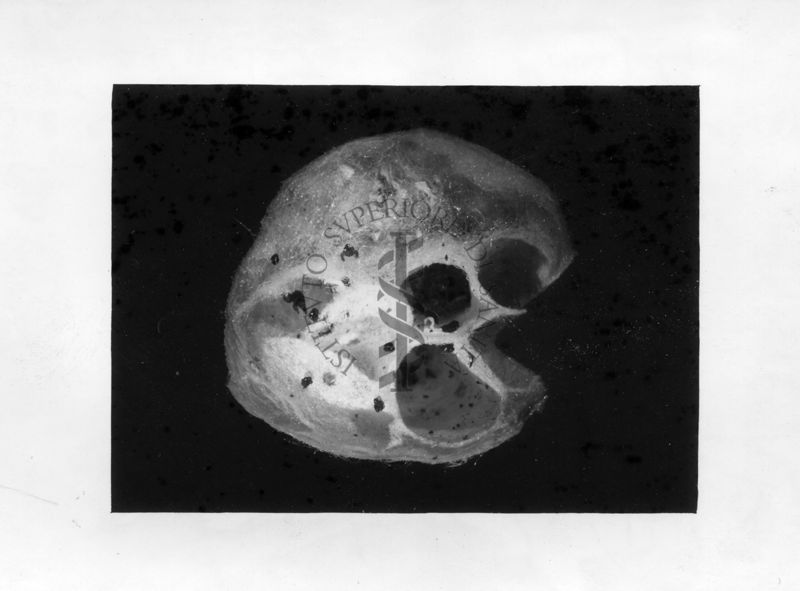 Sezione di un sacco ovigeno attaccato dal parassita Pimpla