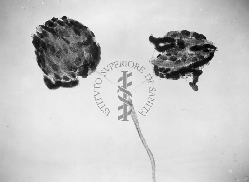 Ginandromorfo di Mosca domestica con gonadi femminili e dotti maschili