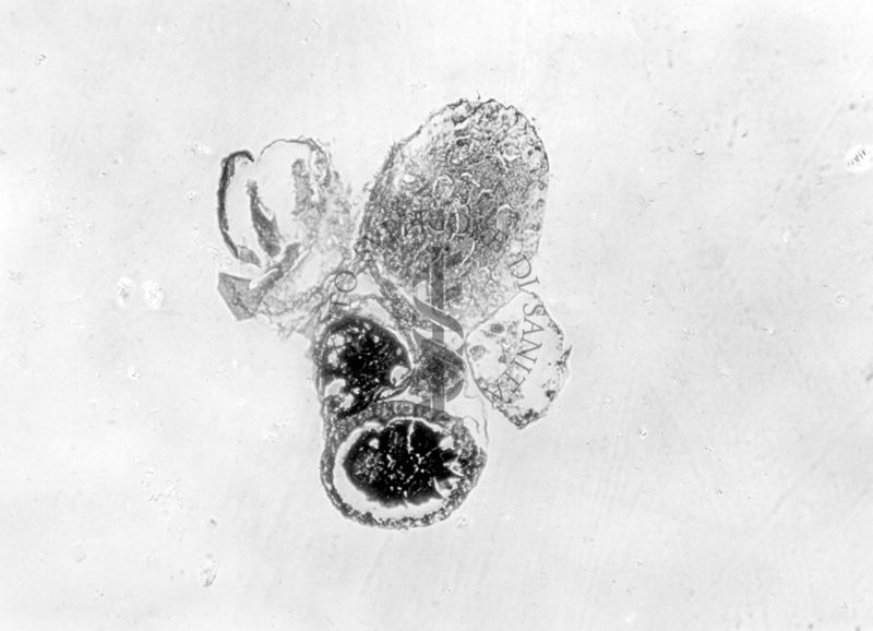 Gonadi con epitelio esterno di sesso opposto ai prodotti sessuali