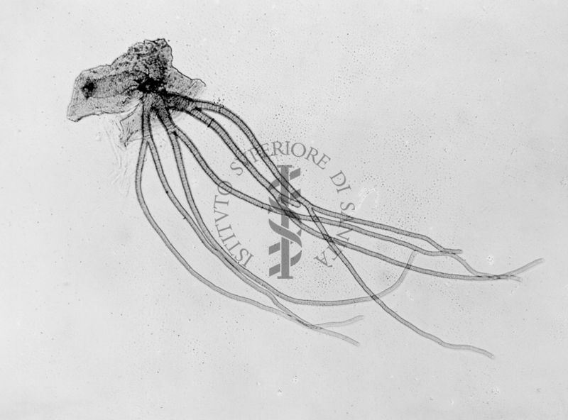 Aberrazione nelle branchie respiratorie in una ninfa di Simulium ornatum