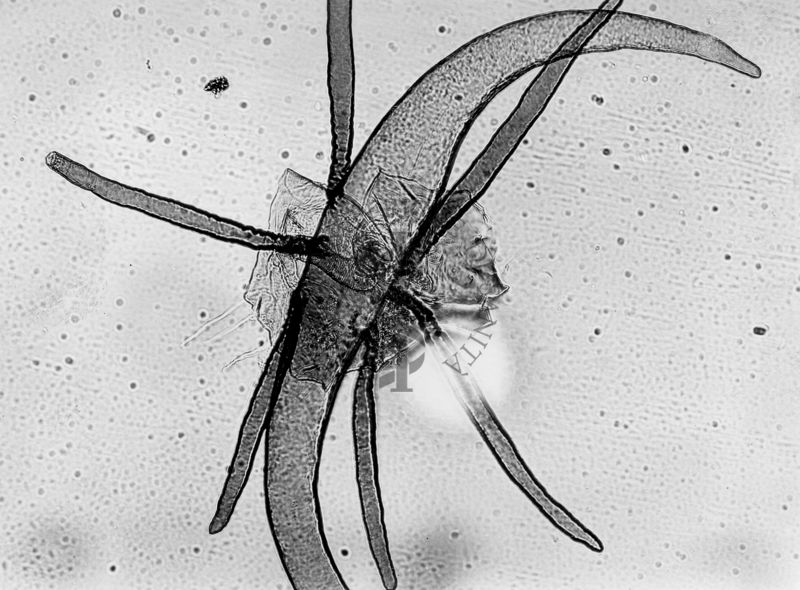 Immagine di branchie respiratorie in una ninfa di Simulium mediterraneum