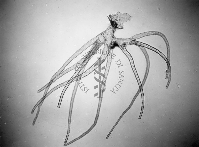 Filamenti bronchiali della ninfa di una specie di Simulide