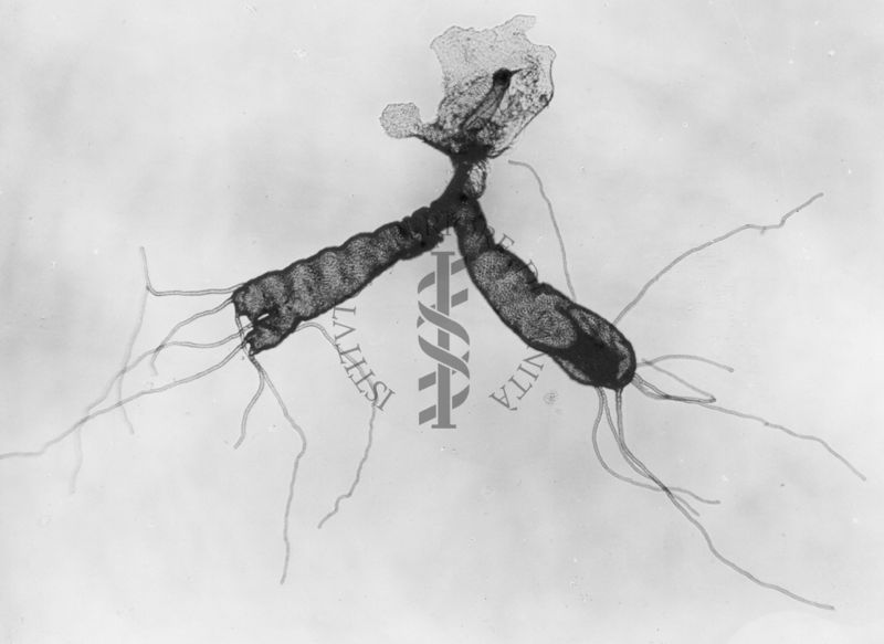 Organi respiratori di una linfa di Simulide