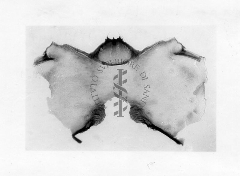 Capo della larva di un Simulide (Diptera)