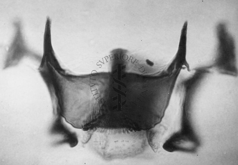 Dettagli morfologici di una nuova specie di Simulidi ovvero piccoli insetti simili a moscerini