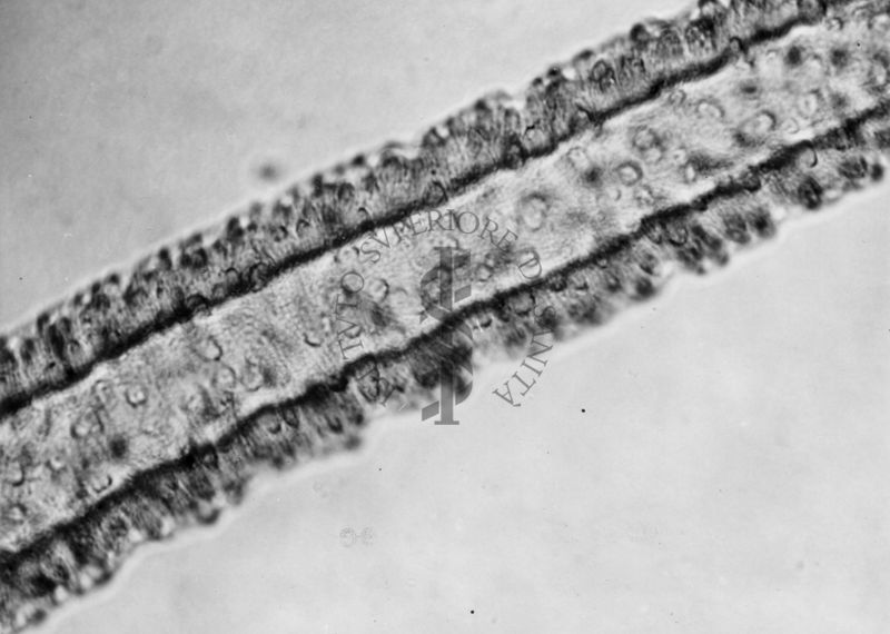Dettagli morfologici di una nuova specie di Simulidi ovvero piccoli insetti simili a moscerini