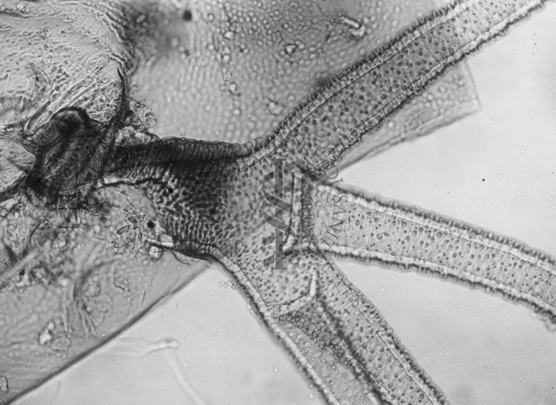 Dettagli morfologici di una nuova specie di Simulidi ovvero piccoli insetti simili a moscerini