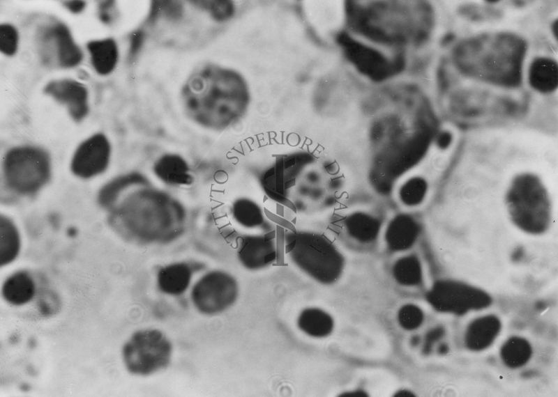 Immagini di Emoprotozoi