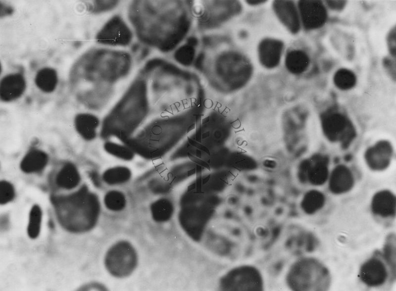 Immagini di Emoprotozoi