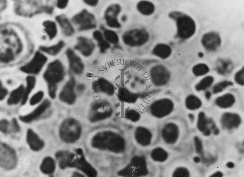 Immagini di Emoprotozoi