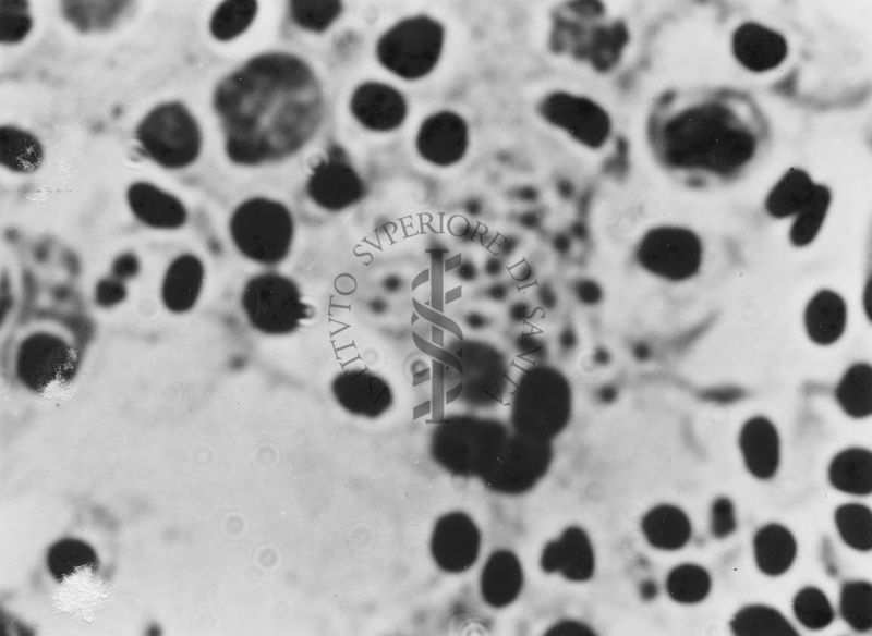 Immagini di Emoprotozoi