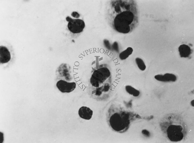 Fotografie di emoprotozoi