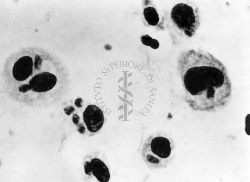 Fotografie di emoprotozoi