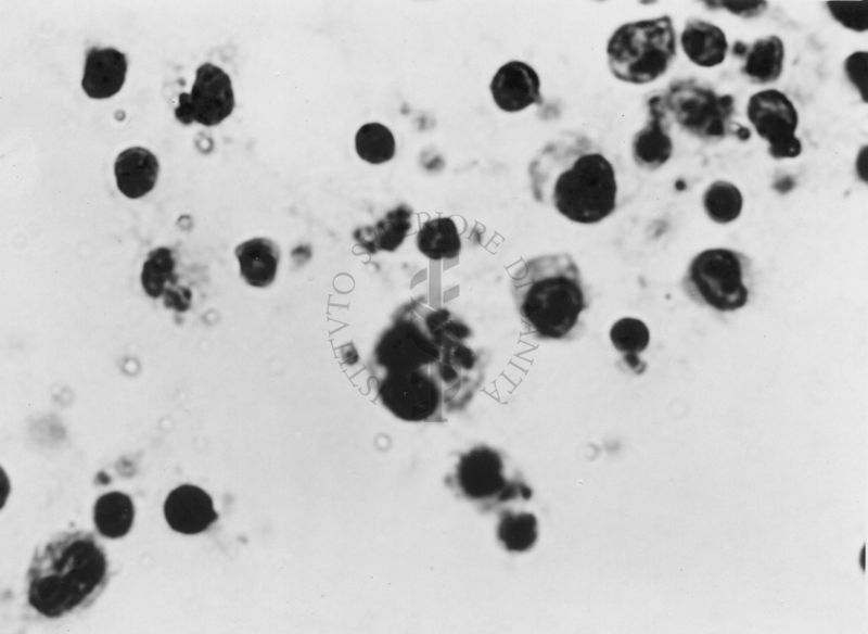 Fotografie di emoprotozoi