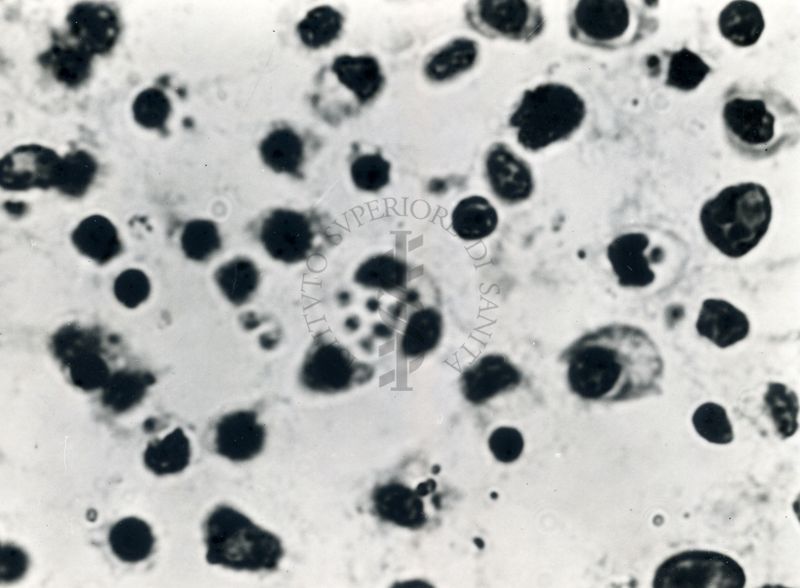 Fotografie di emoprotozoi