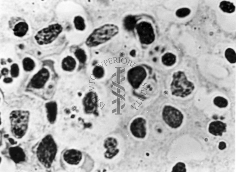 Fotografie di emoprotozoi