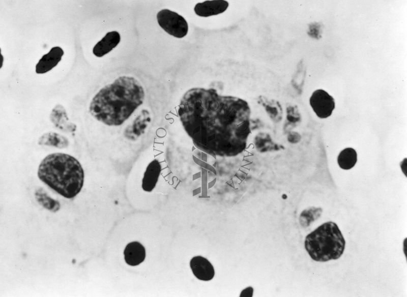 Fotografie di emoprotozoi