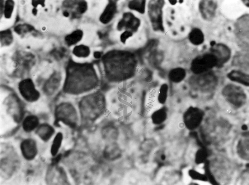 Fotografie di emoprotozoi