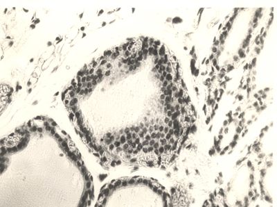 Azione del fluoro sulla tiroide in animali normali ed ipofisectomizzati