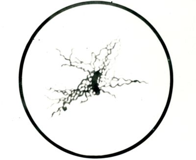 Vibrione settico (colorazione delle ciglia)