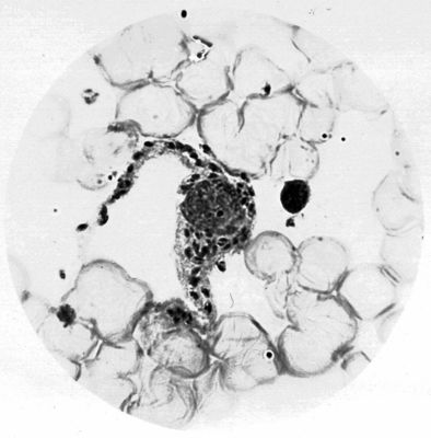 Leishmania tropica nel citoplasma di un istrocite (lesione cutanea umana) Abruzzi