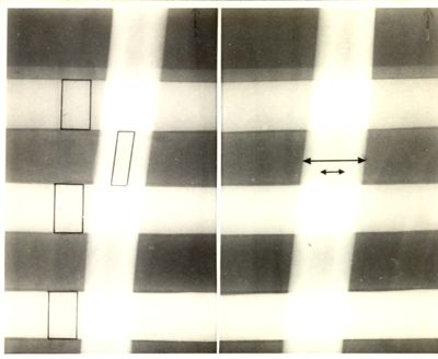 Radiografia di un braccio con campioni di assorbimento