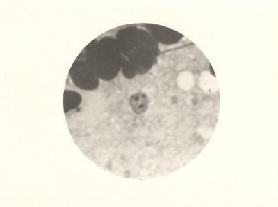 Forme di protozooiti e di sporozooiti prima di entrare nel sangue